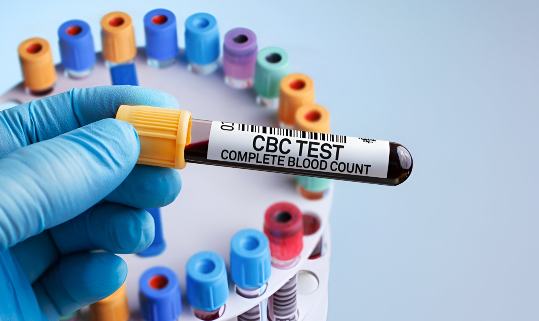 CBC Levels Test