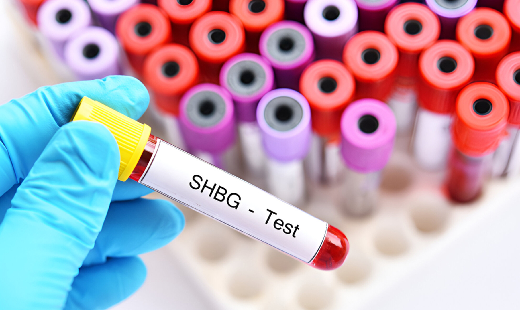 SHBG Test