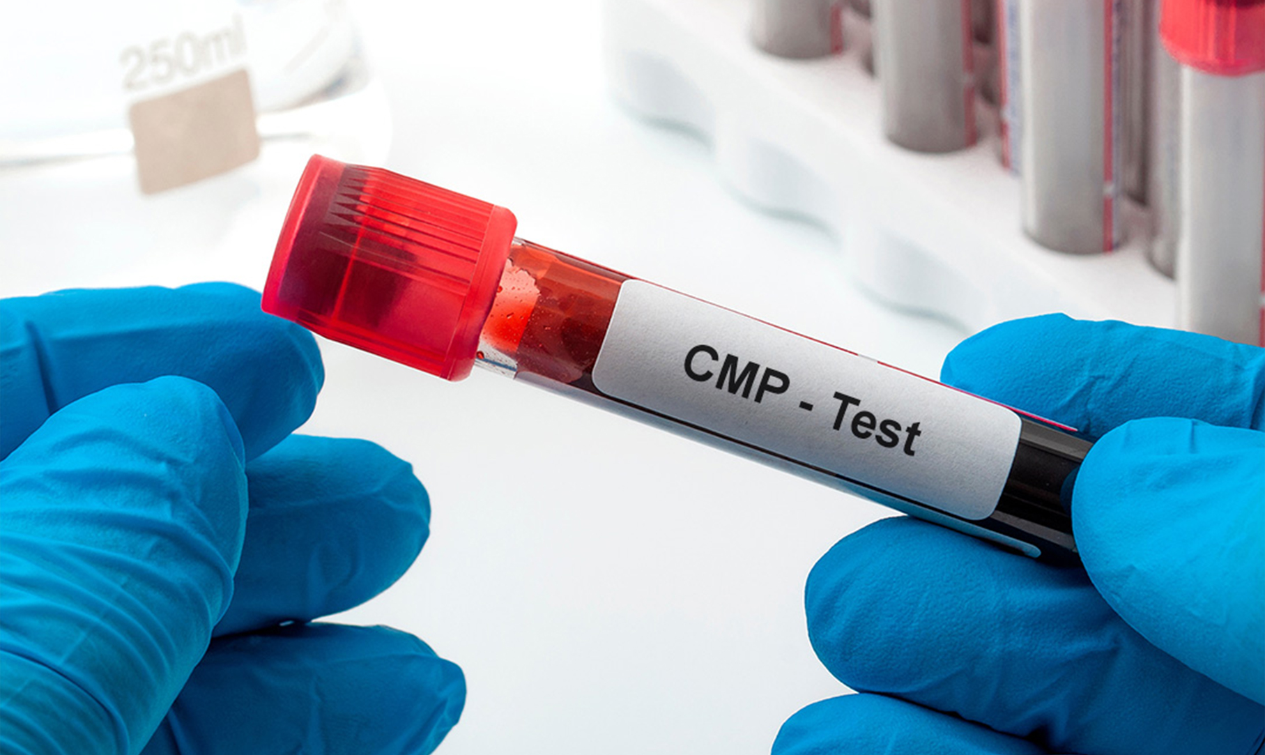 CMP Levels Test