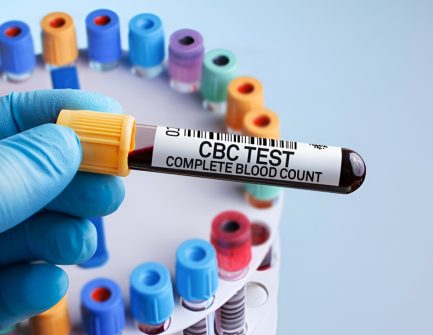 CBC-Levels.jpg