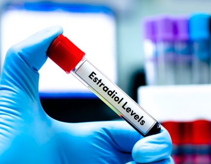 Estradiol-Levels.jpg