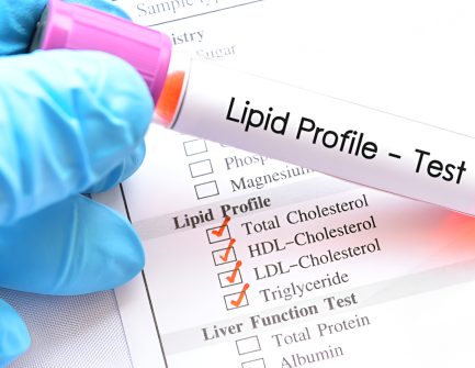 Lipidw.jpg
