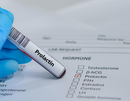 Prolactin.jpg