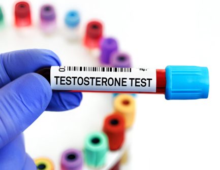 Testosterone-Levels.jpg