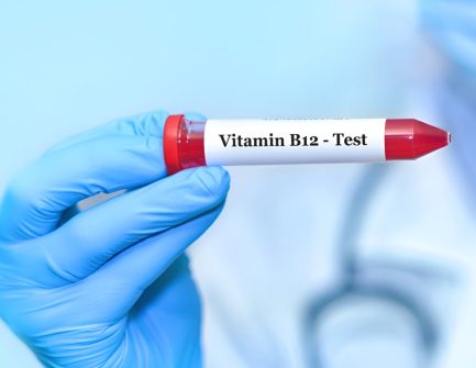 Vitamin-B12-–-Folate.jpg