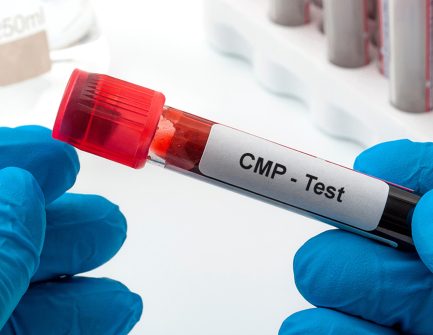 cmp-levels.jpg